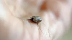 Kleszcz na skórze: co robić i gdzie się zgłosić po ukąszeniu